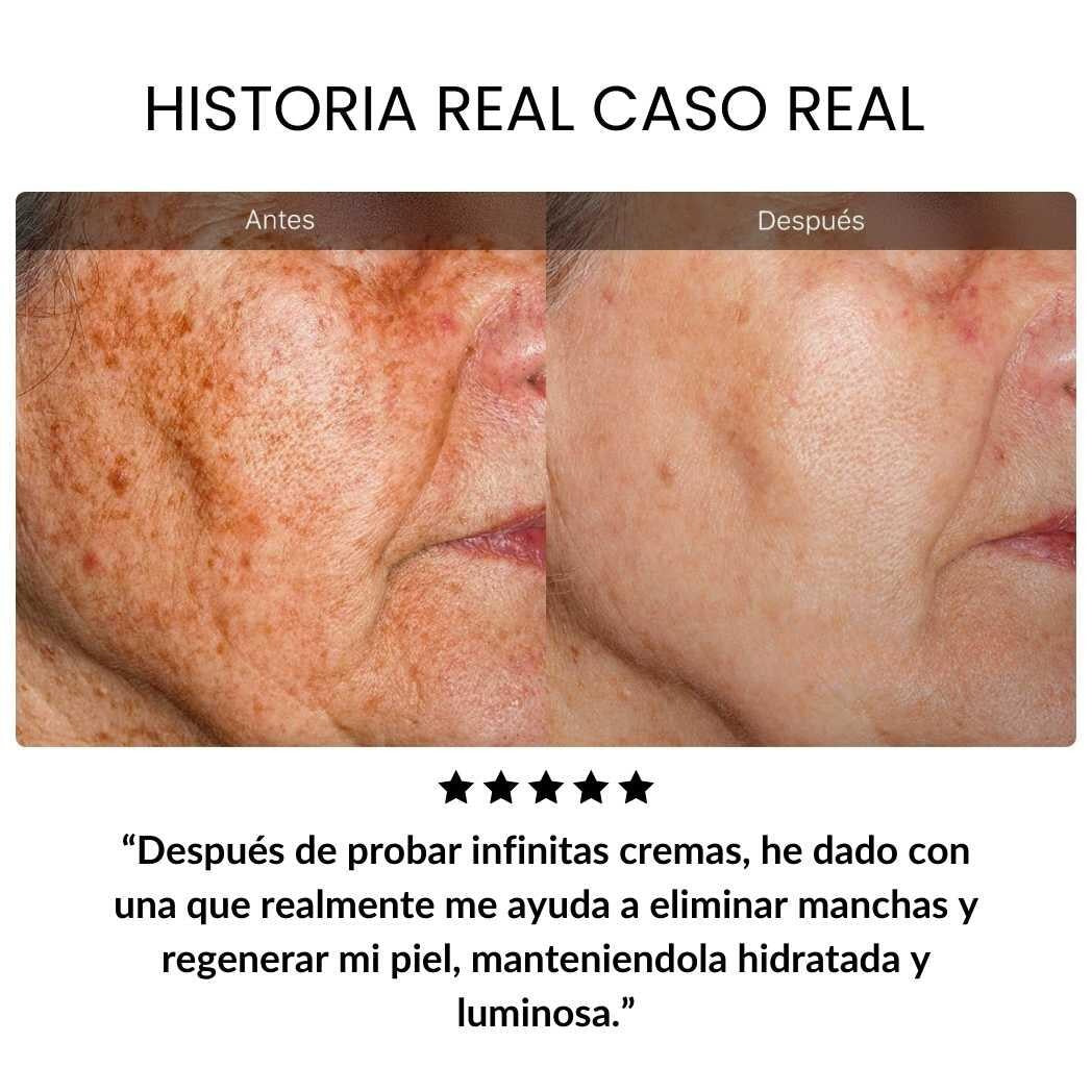 Crema antiedad